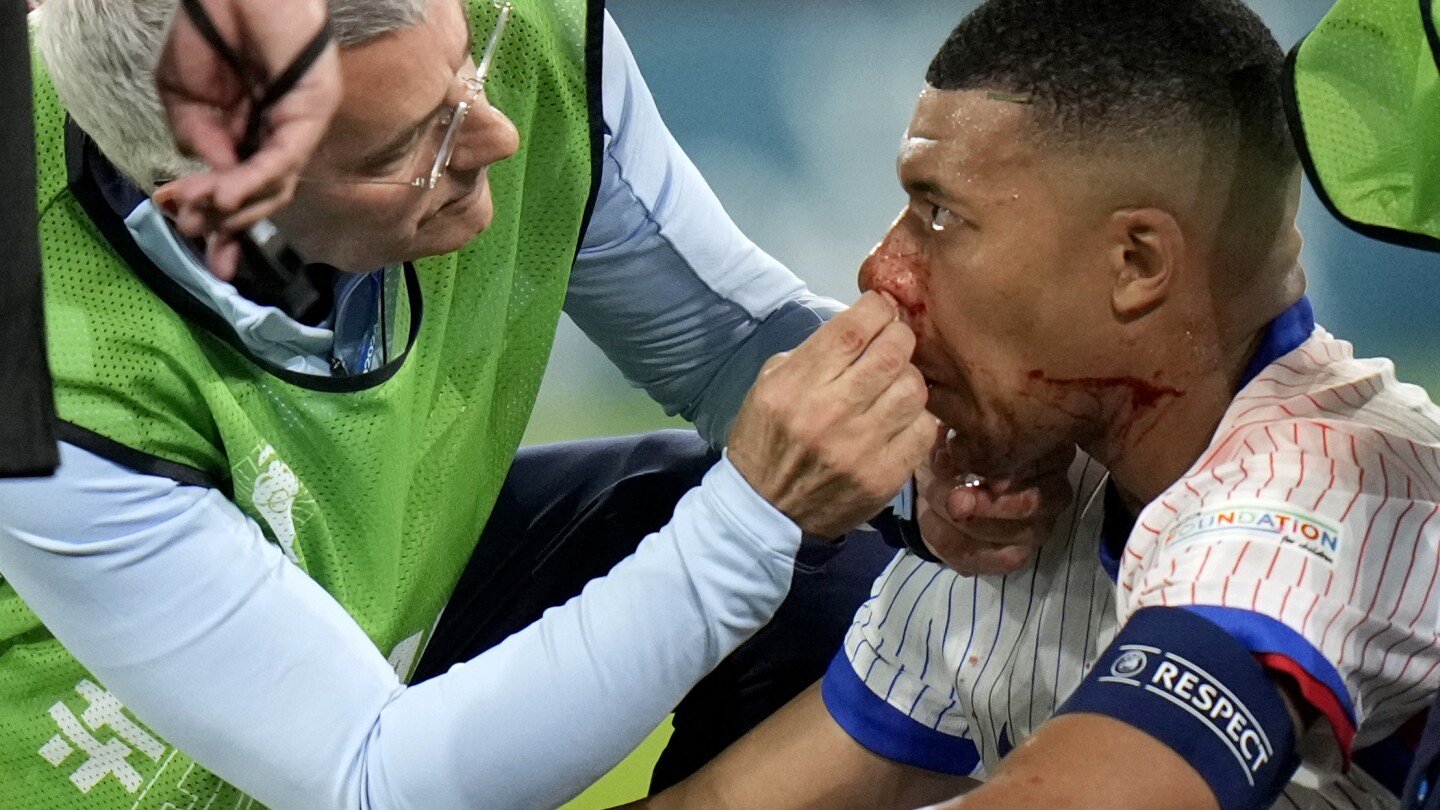 mbappe-suffers-head-injury-in-france’s-euro-2024-game-against-austria