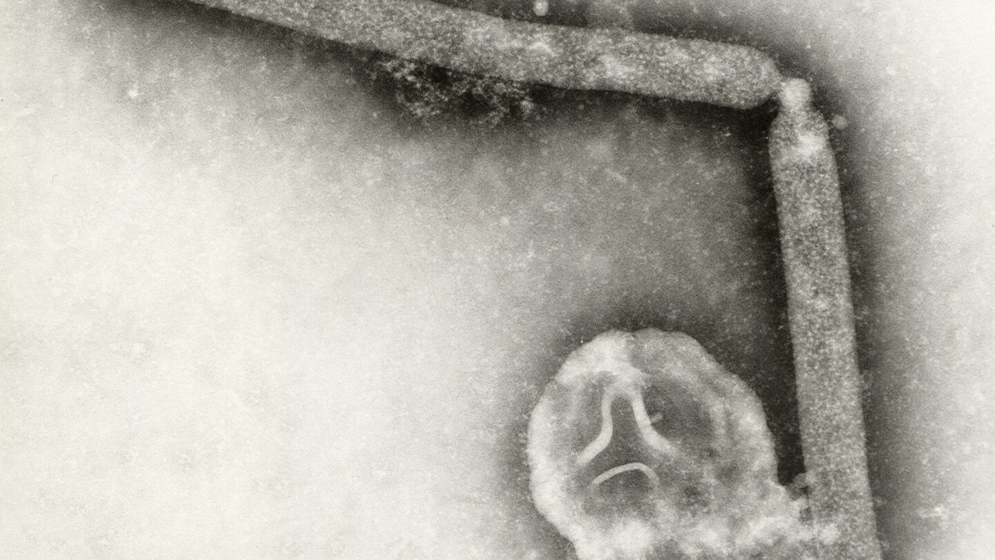 los-cdc-detectan-posible-mutacion-del-virus-de-la-gripe-aviar-en-un-paciente-de-luisiana