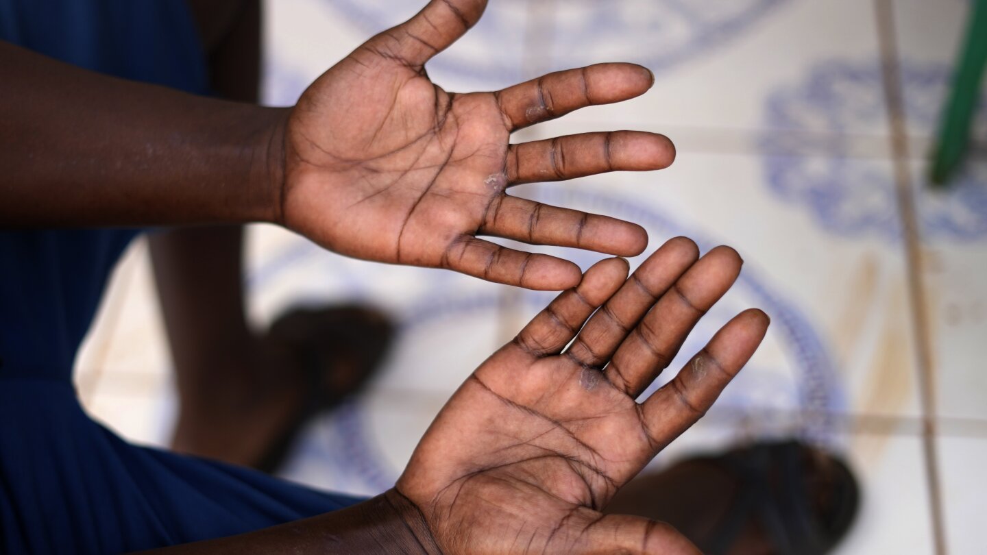 south-african-miner-describes-horrors-for-those-who-spent-months-underground