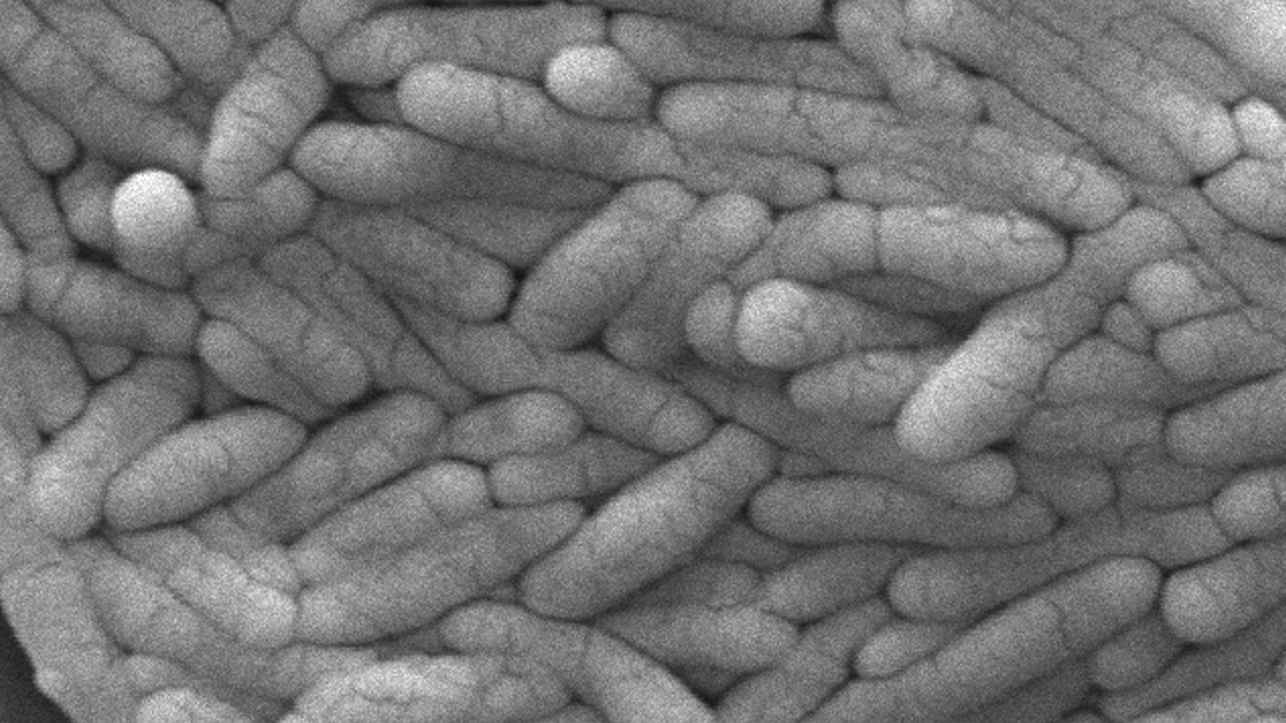 new-salmonella-outbreak-is-linked-to-backyard-poultry,-cdc-says