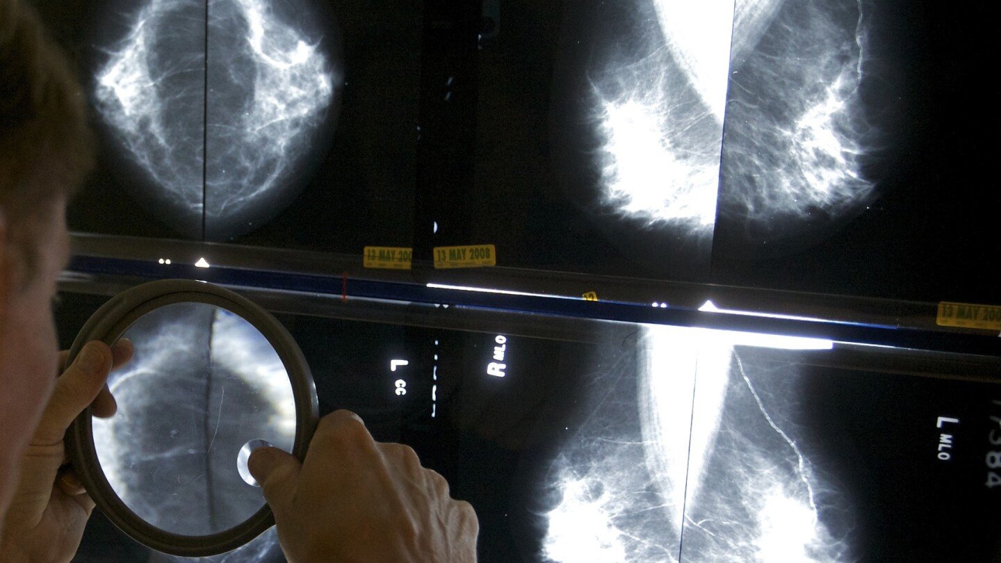 cancer-before-age-50-is-increasing.-a-new-study-looks-at-which-types
