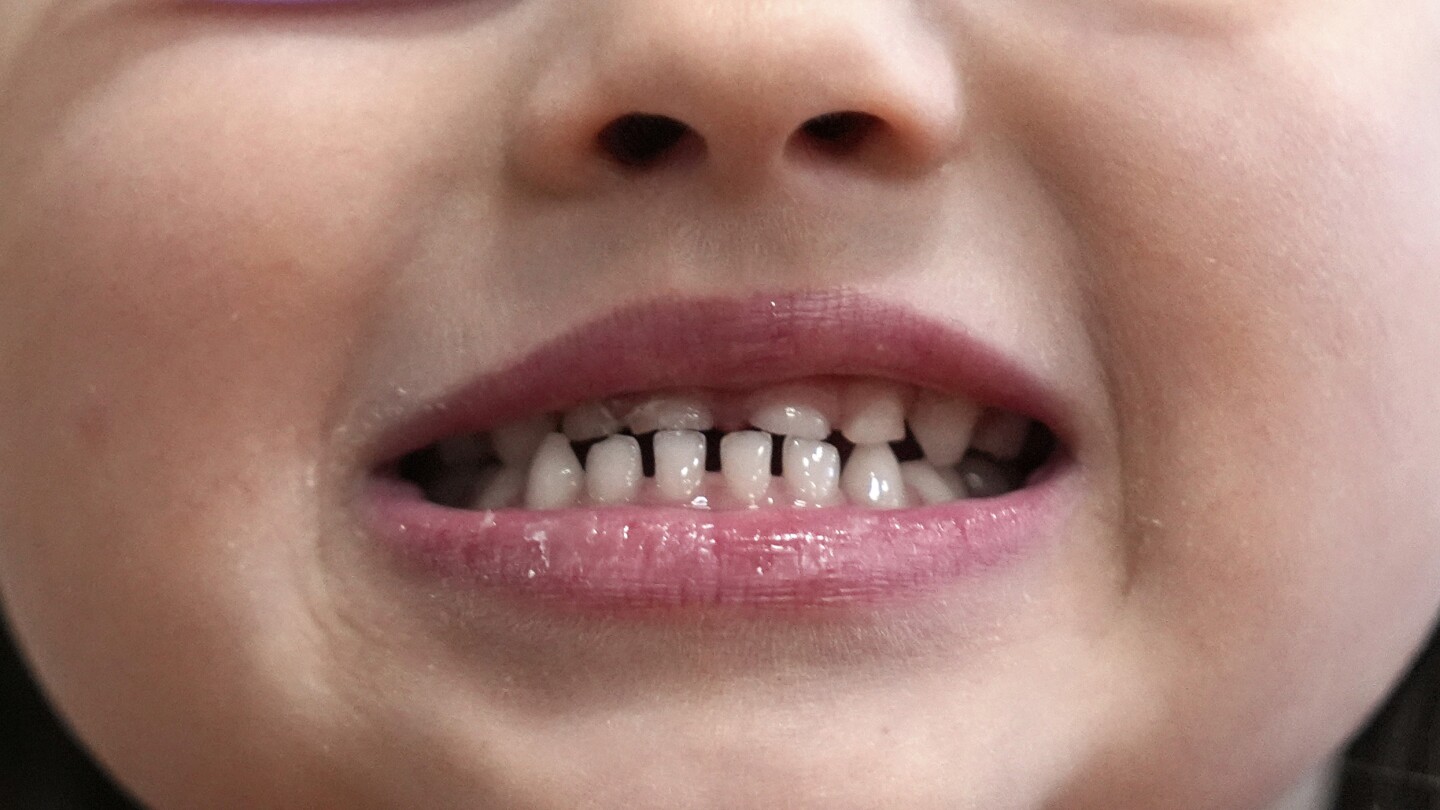 fda-and-rfk-jr.-aim-to-remove-fluoride-supplements-used-to-protect-kids’-teeth