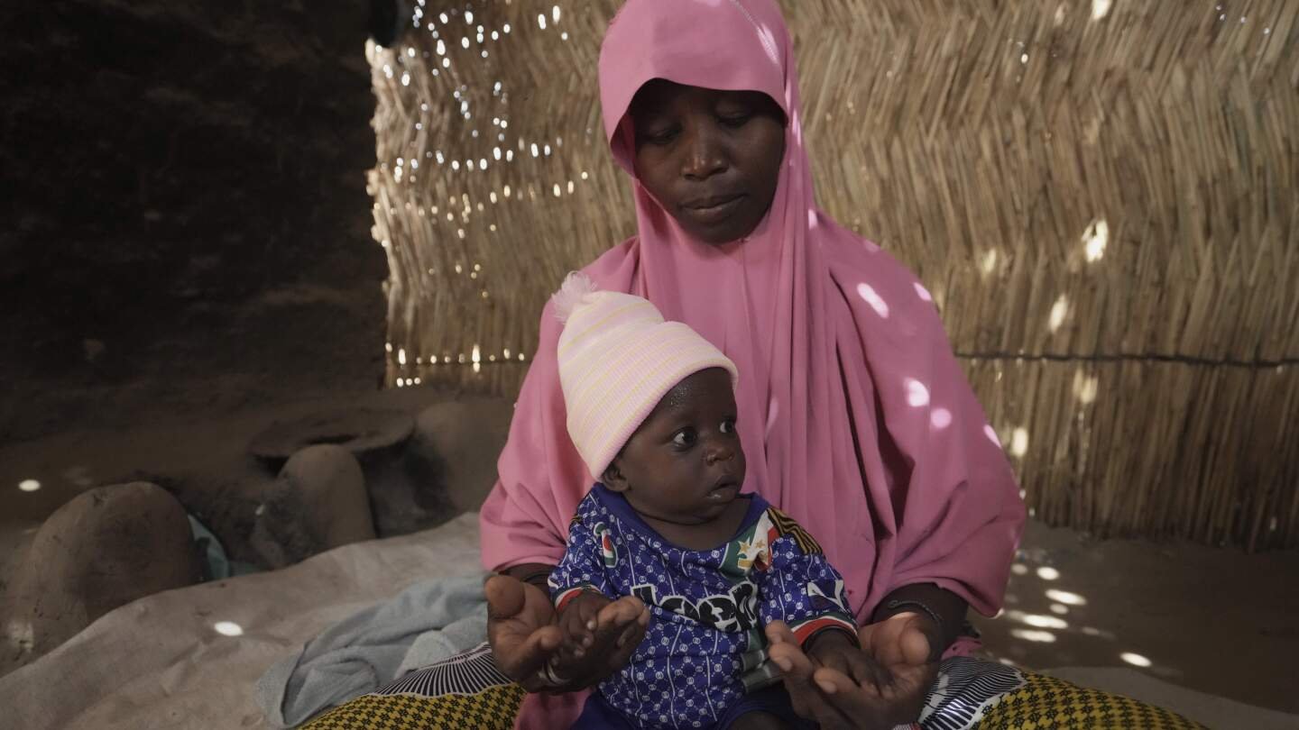 children-die-as-usaid-aid-cuts-snap-a-lifeline-for-the-world’s-most-malnourished