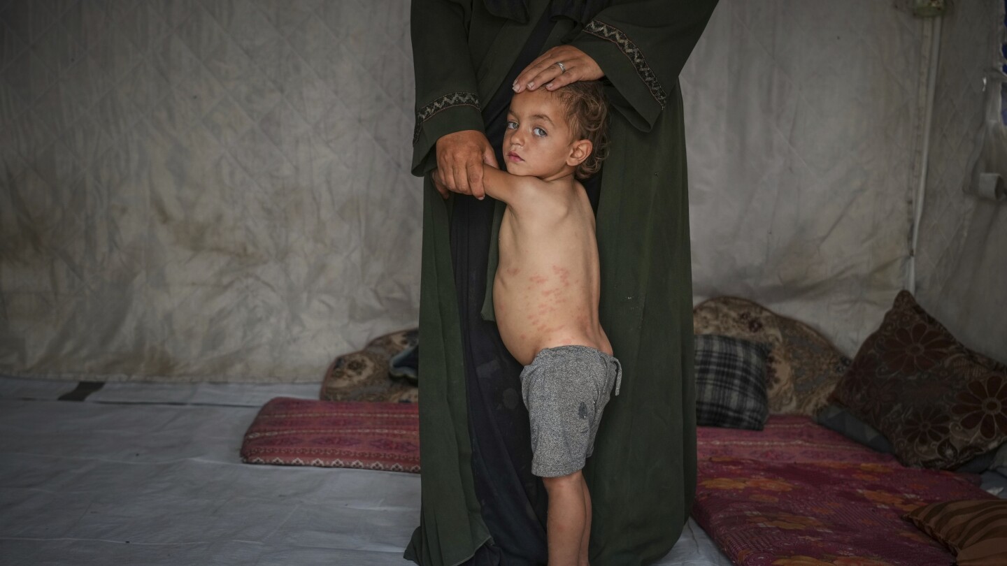 photo-gallery:-scenes-from-gaza