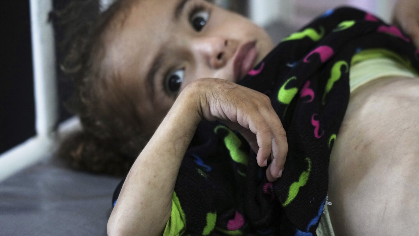 mothers-and-their-babies-face-starvation-in-gaza,-where-hospitals-are-overwhelmed
