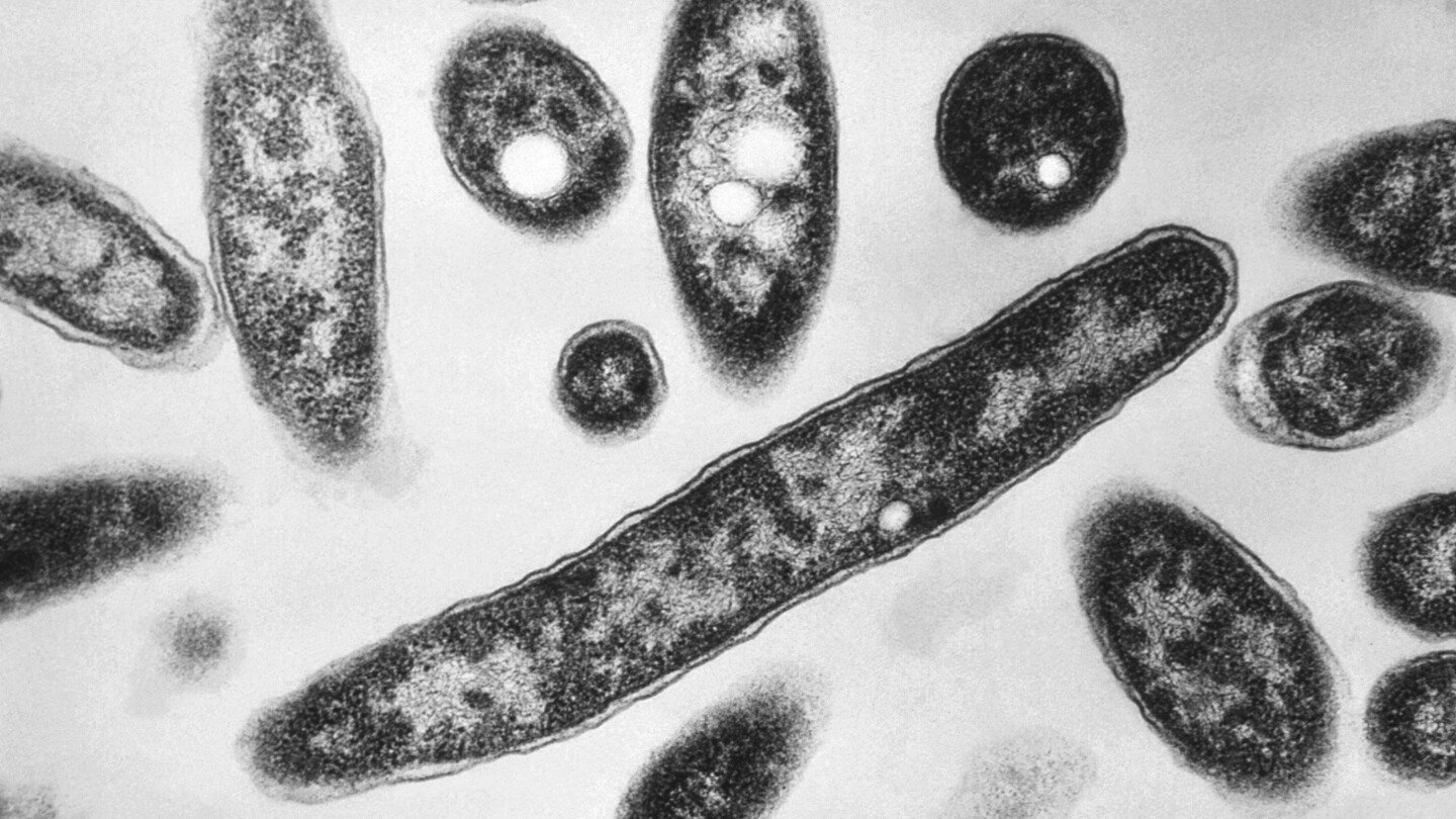 what-to-know-about-legionnaires’-disease,-which-has-sickened-dozens-in-new-york-city