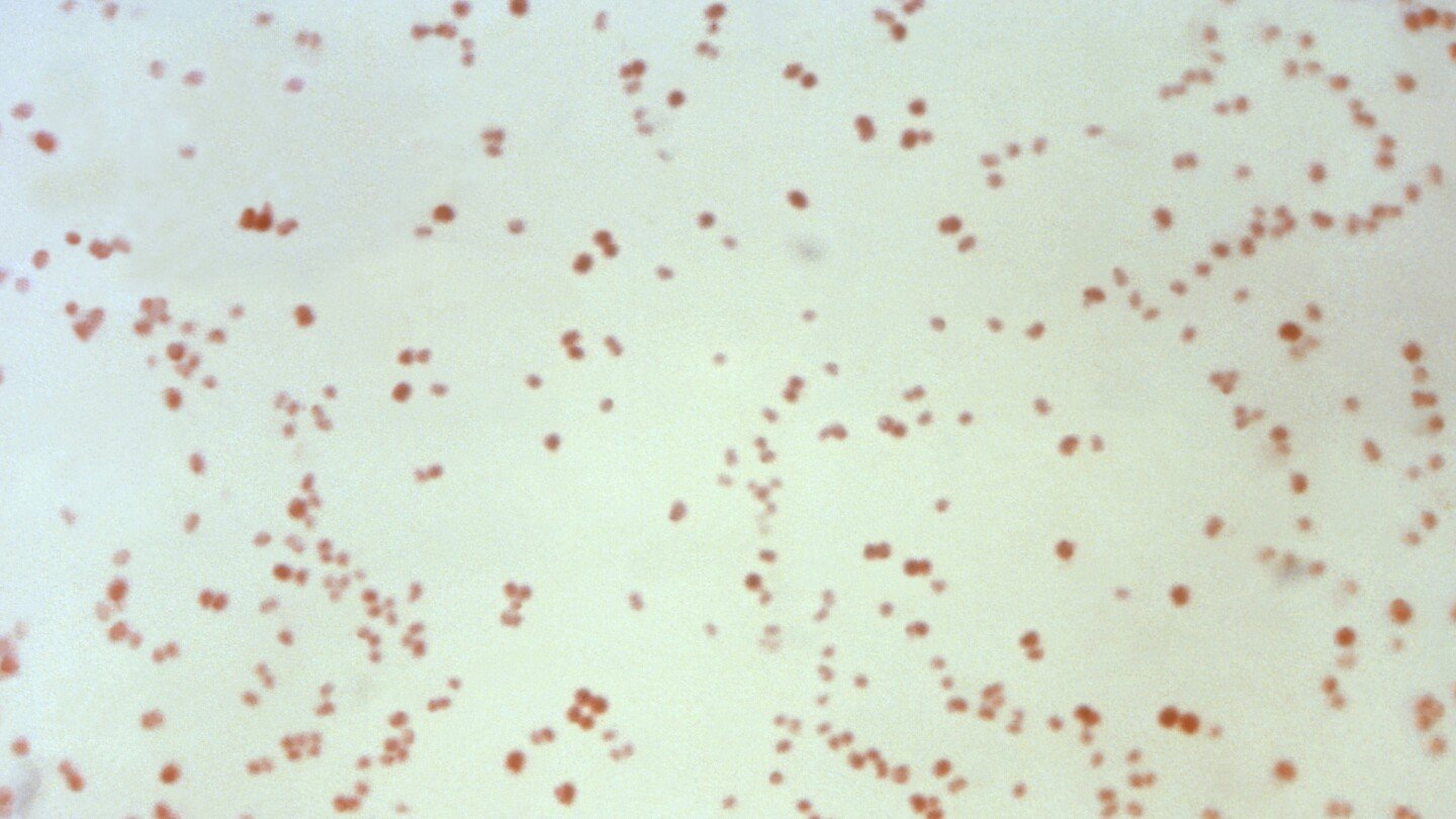 sexually-transmitted-disease-cases-fall,-but-not-syphilis-in-newborns