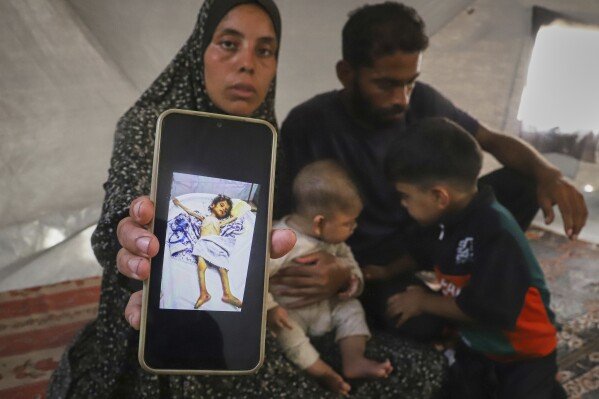 FILE - Sitting next to her husband, Amin, and two of their children, Fatma Mashi shows a photo on her cellphone of the body of her 2½-year-old daughter, Ro'a, who doctors say had no preexisting conditions and died of severe malnourishment, at their tent in Muwasi, southern Gaza Strip, Aug. 8, 2025. Experts say it's not unusual for one family member to fare worse than the others. (AP Photo/Mariam Dagga)