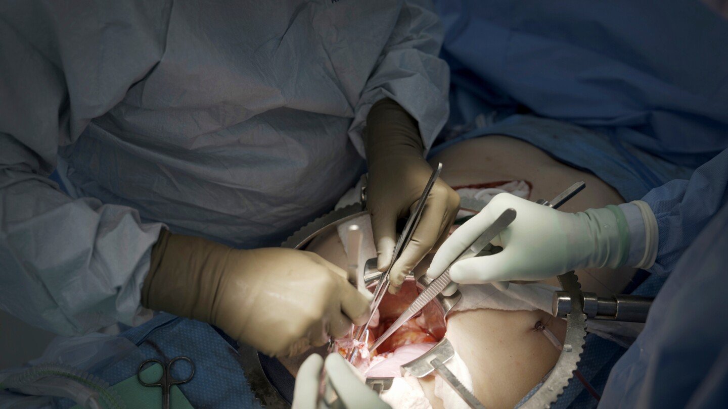 first-clinical-trial-of-pig-kidney-transplants-gets-underway