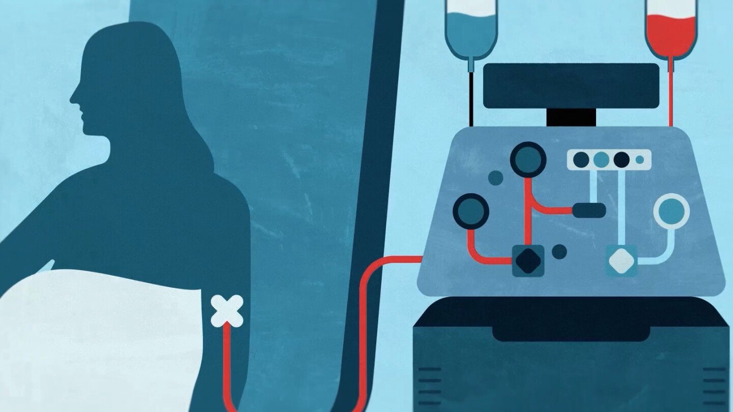 researchers-try-bold-new-approach-in-a-race-to-better-treat-autoimmune-diseases