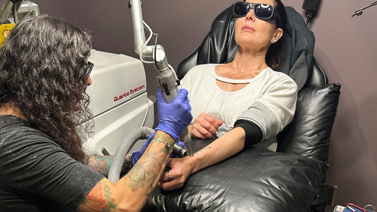 if-you-want-that-tattoo-erased-it’s-going-to-hurt-and-it’s-going-to-cost-you