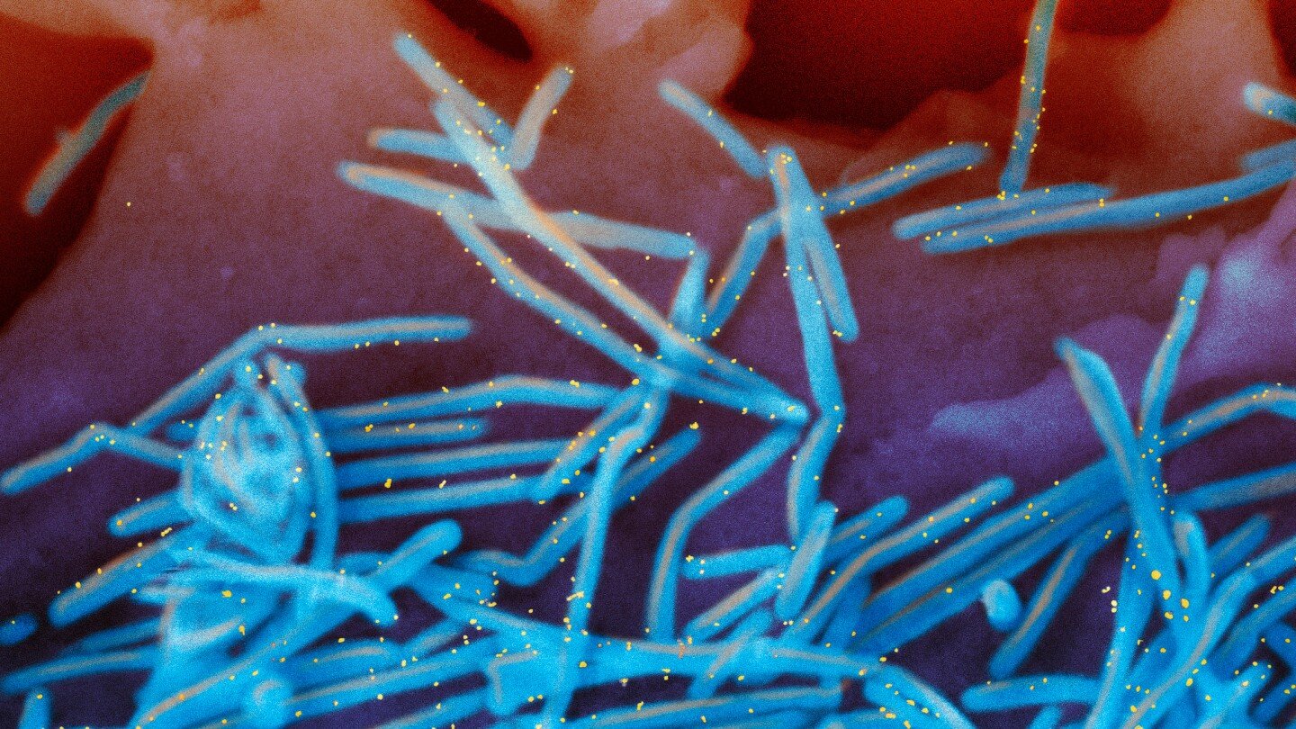 winter-virus-season-so-far-is-not-too-bad,-but-doctors-worry-about-suffering-to-come