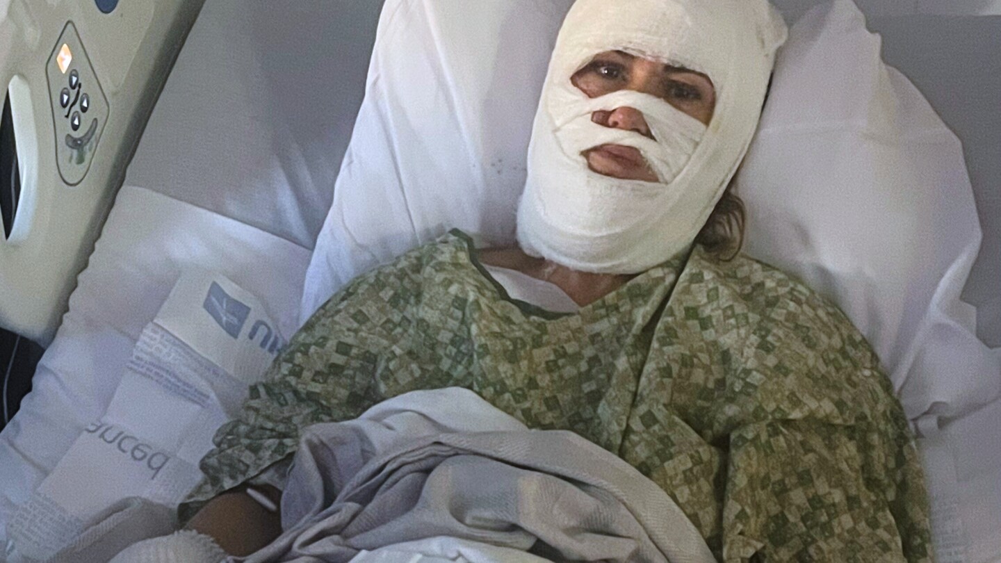 a-georgia-woman-suffers-severe-burns-in-a-chemical-attack-at-a-savannah-park