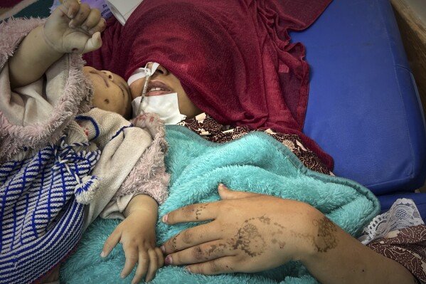 Shaima Seiam lies wounded at Nasser Hospital beside the body of her infant daughter, Ahlam, who was days away from her first birthday, after their home was hit by an Israeli airstrike, in Khan Younis, southern Gaza Strip, April 16, 2025. (AP Photo/Mariam Dagga)
