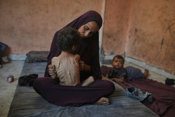 Naima Abu Ful poses for a photo with her 2-year-old malnourished child, Yazan, at their home in the Shati refugee camp in Gaza City, on July 23, 2025. (AP Photo/Jehad Alshrafi)