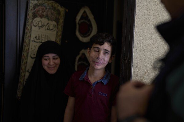 Hussein Dheini, 12, who was wounded in the pagers attack carried out by Israel on September 17, 2024, stands next to his mother, Faten Haidar, at the entrance of their home in the village of Teir Debba, southern Lebanon, on May 1, 2025. (AP Photo/Hassan Ammar)