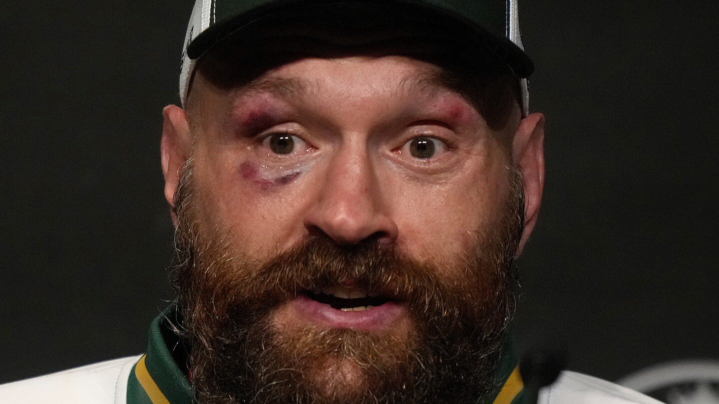 tyson-fury-says-he-is-coming-out-of-retirement-in-2026