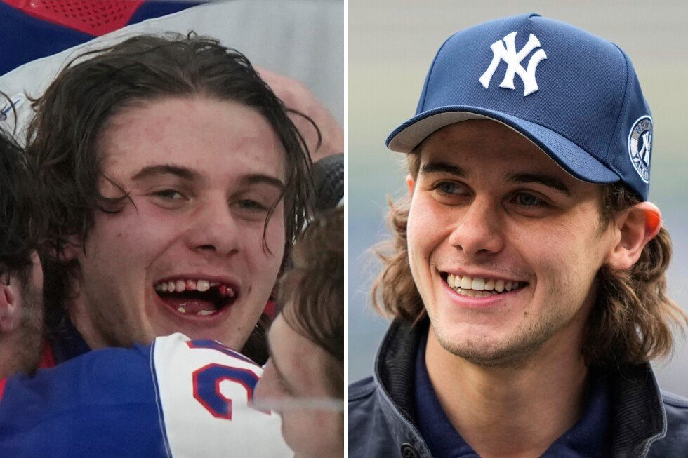 jack-hughes’-golden-goal-is-a-reminder-of-how-important-hockey-dentists-are