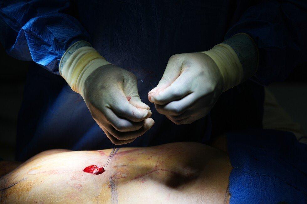 experts-urge-ethical-debate-as-cosmetic-procedures-become-the-norm