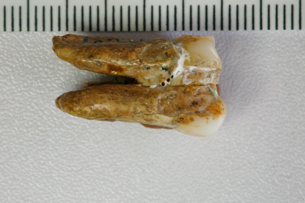 new-clues-about-homo-erectus-emerge-from-study-of-ancient-teeth