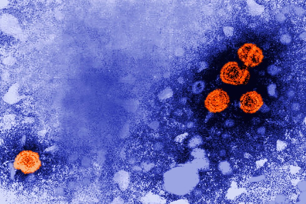 experimental-drug-for-hepatitis-b-shows-promise-in-reducing-virus-levels