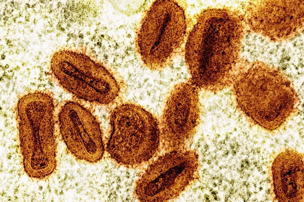 2-scientists-charged-with-bringing-deactivated-mpox-virus-into-us-without-permission