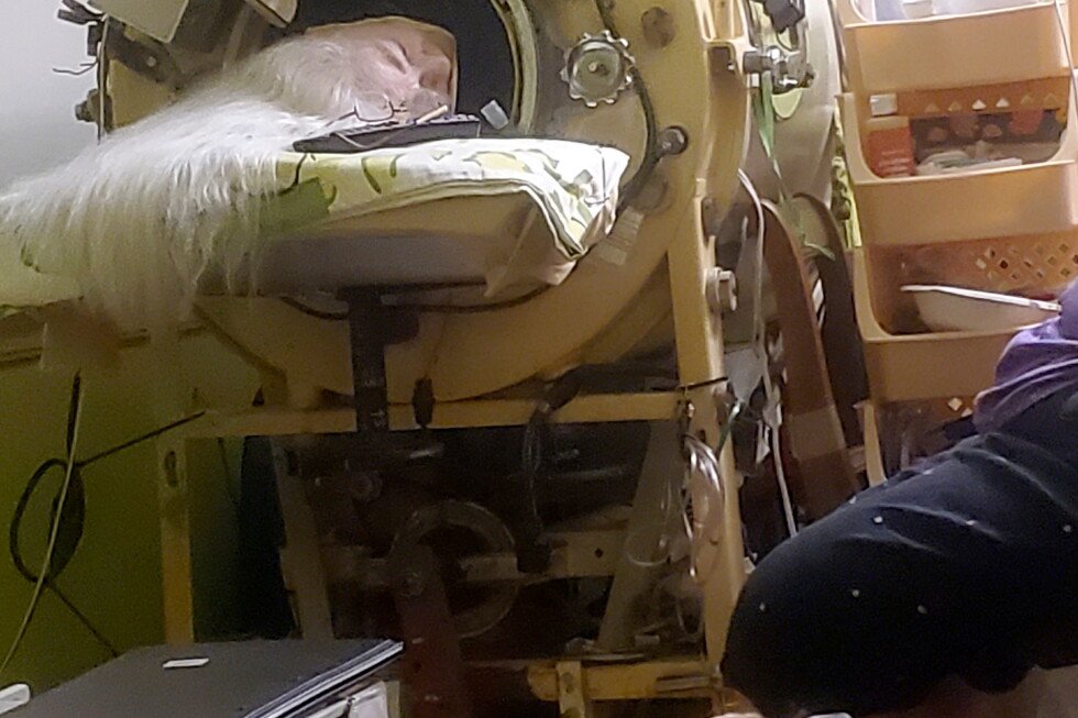 martha-lillard,-last-us-polio-patient-using-iron-lung,-dies-at-78