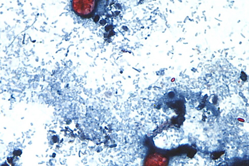 michigan-eyes-lettuce-in-cyclospora-outbreak;-taco-bell-pulls-some-items