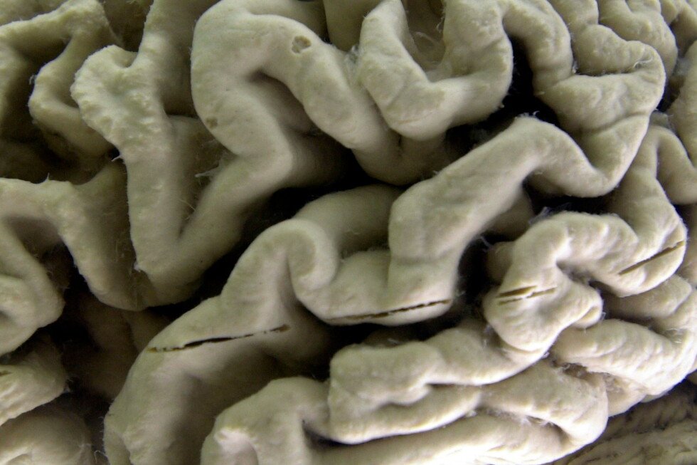 a-blood-test-may-predict-the-start-of-alzheimer’s-symptoms-years-in-advance