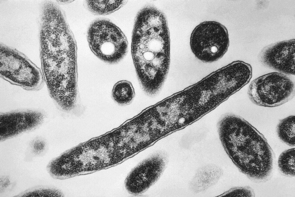 legionnaires’-disease-outbreak-in-new-york-city-kills-two,-sickens-dozens