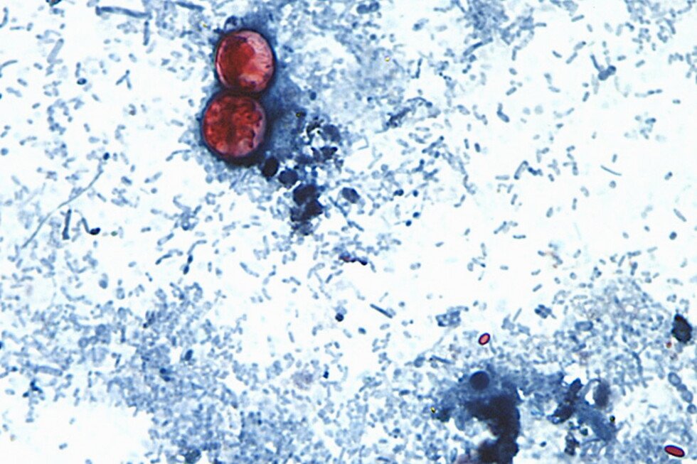 brote-de-ciclosporiasis-vinculado-a-lechuga-se-extiende-a-15-estados-de-eeuu,-dicen-los-cdc