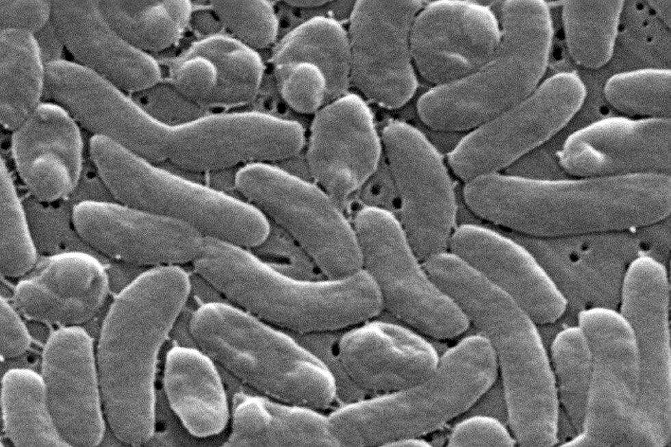 louisiana-health-officials-warn-beachgoers-of-flesh-eating-bacteria-risk