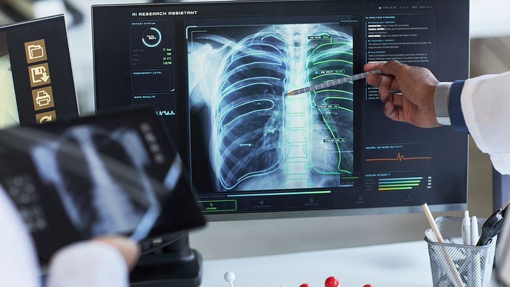 deal-valued-at-$1.1-billion-sends-this-x-ray-stock-soaring-48%
